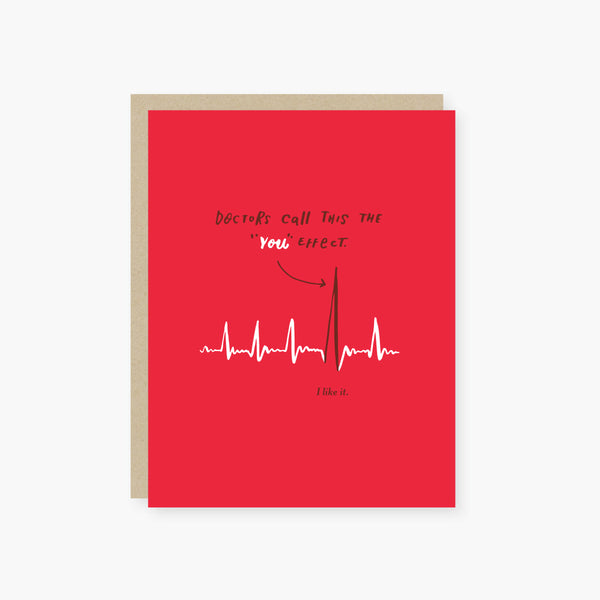 ekg spike love card